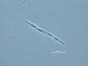 Photo of Pseudo-nitzschia spp. (large-celled)
